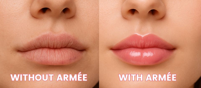 Lip Revival: Our Top Post-Summer Repair Must-Haves