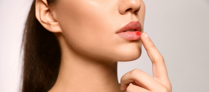 6 Trending Lip Care Ingredients that Promote Healthy, Plump Lips