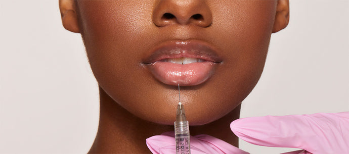 Lip Filler Aftercare Q&A - "How Long Does It Take for Lip Fillers to Settle?